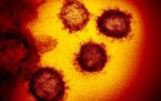 An image from an electron microscope shows SARS-CoV-2, the virus that causes COVID-19. The Pfizer Inc. and BioNTech SE COVID-19 vaccine appeared to