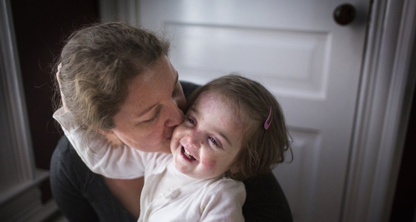 Elisa McCann, 2, plays with her mother Gabriella in their St. Paul home on Tuesday, October 6, 2015. ] LEILA NAVIDI leila.navidi@startribune.com / BACKGROUND INFORMATION: 2-year-old Elisa McCann was born with a genetic condition, epidermolysis bullosa, that causes her skin to blister and sluff off at the slightest contact. It's like having third-degree burns all over your body and drugs like oxycodone and morphine are not good long term solutions to manage her pain. Her mother, Gabriella McCann,