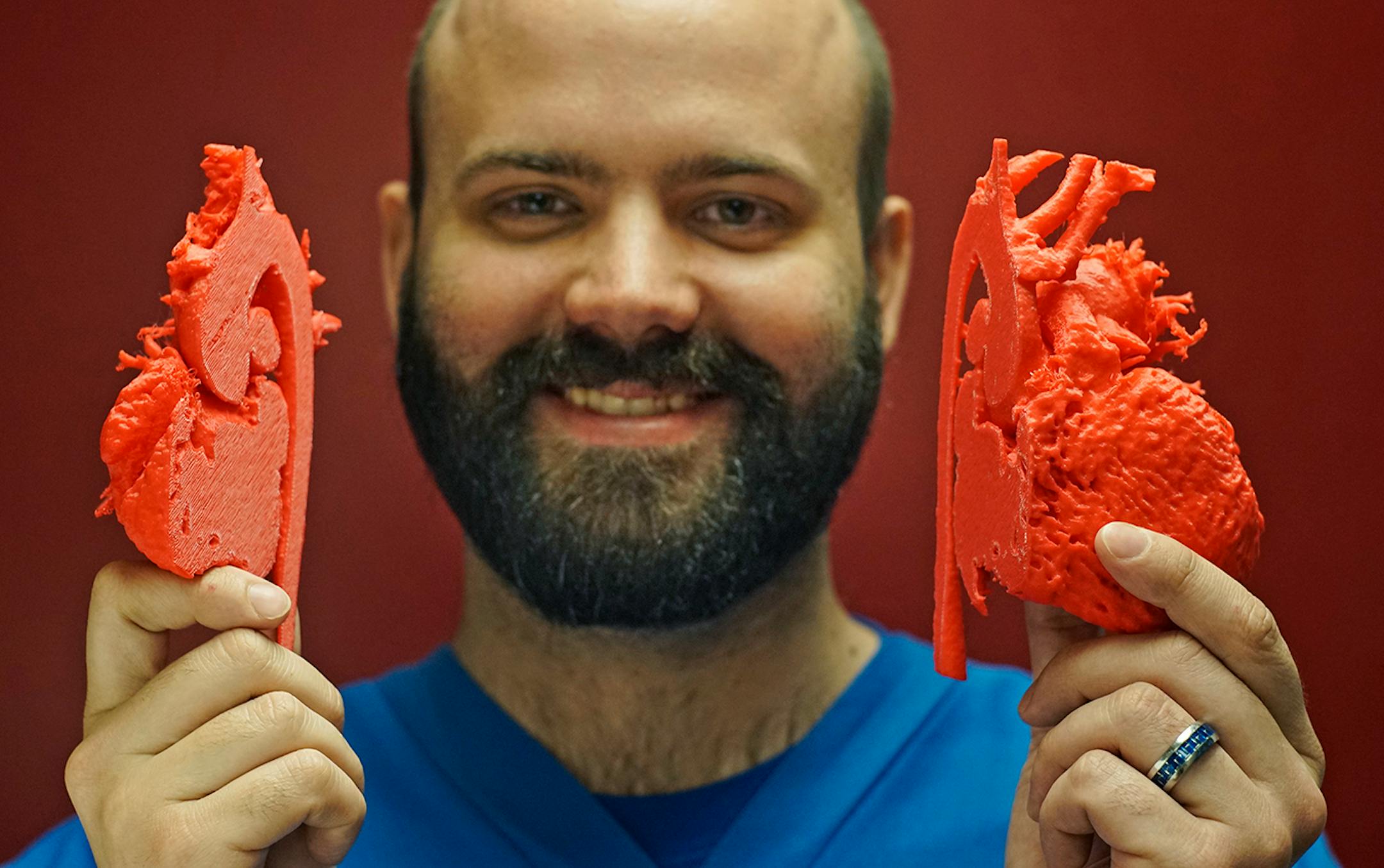 At the Visible Heart Research laboratory on the U of M campus, Ph.D. candidate Brian Howard shows a 3D model of the blood flow of a 10-year old's heart which has been implanted with a stent.