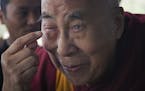 Tibetan spiritual leader the Dalai Lama points to his swollen right eye as he talks to journalists before boarding his chartered flight in Dharmsala, 