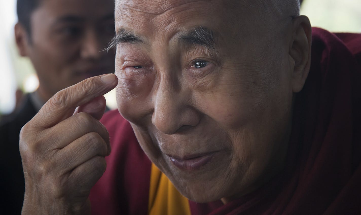 Tibetan spiritual leader the Dalai Lama points to his swollen right eye as he talks to journalists before boarding his chartered flight in Dharmsala, India, Tuesday, Jan. 19, 2016. The Tibetan leader said that he was going to the Mayo Clinic in Rochester, for a regular medical checkup.