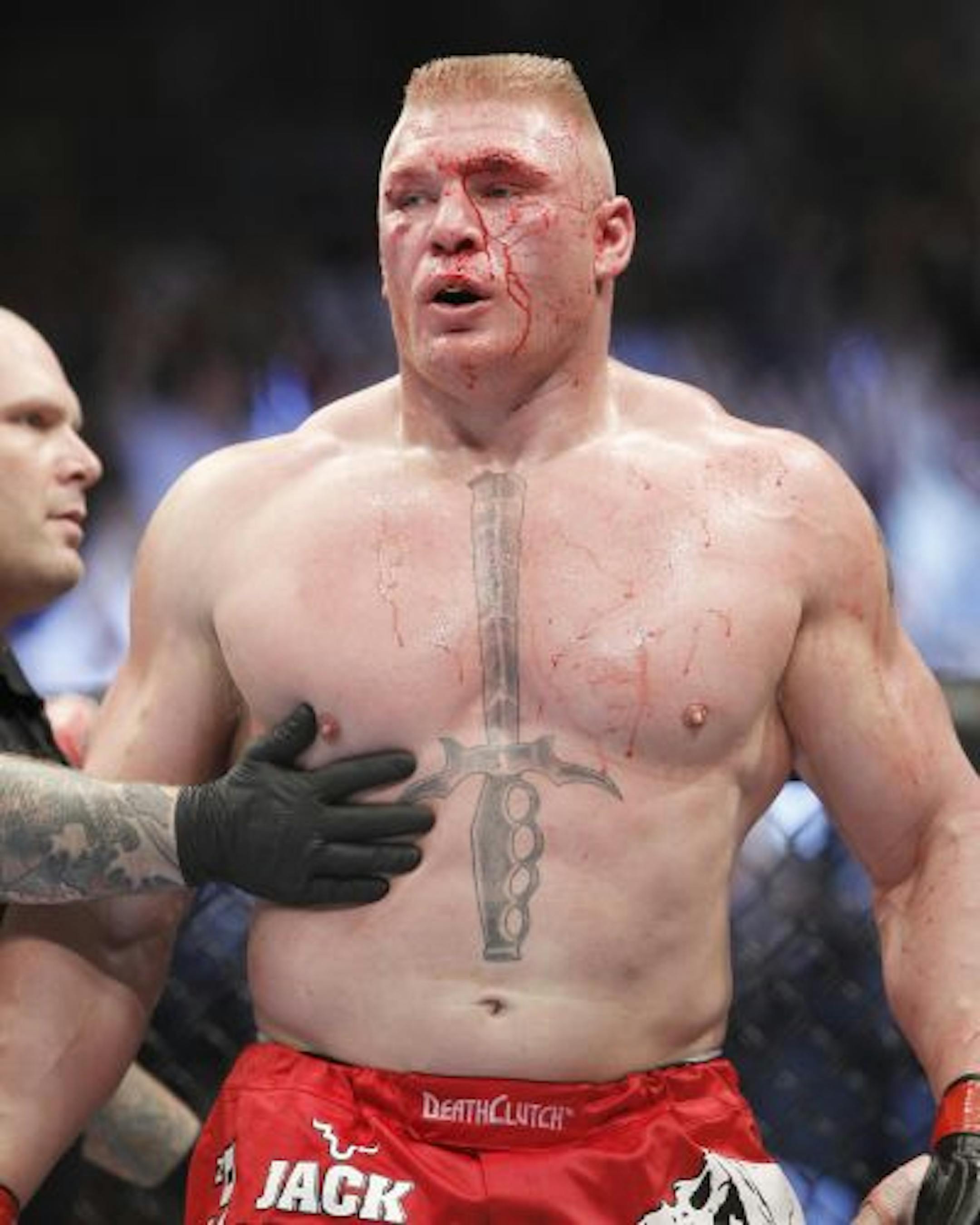 Brock Lesnar walks to his corner at the end of the first round during his UFC heavyweight mixed martial arts title match against Shane Carwin, Saturday, July 3, 2010, at The MGM Grand Garden Arena in Las Vegas.