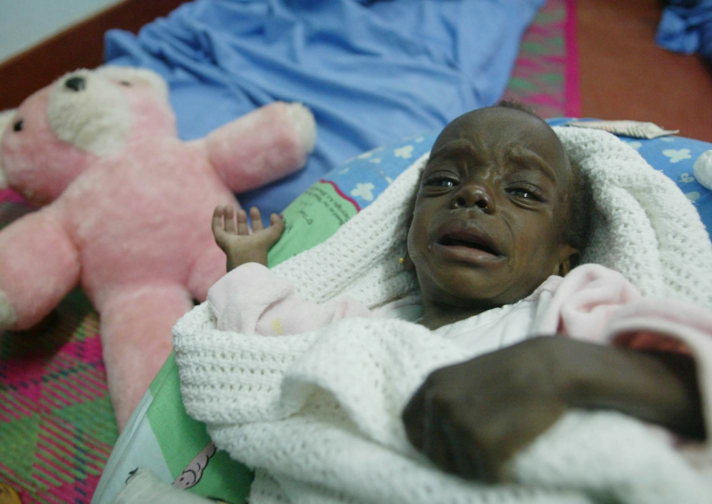 HIV-positive seven-month-old Sonya cries, Wednesday, July 9, 2003 at the Mildmay centre for HIV patients outside Kampala, Uganda. Compared to the other countries U.S. President George W. Bush is visiting in Africa, Uganda is a political and economic lightweight with few demoractic credentials. Bush, however, has other reasons for making a four-hour stop Friday in the landlocked East African country when it comes to security and trade, America and Uganda's policies may as well be tailored for eac