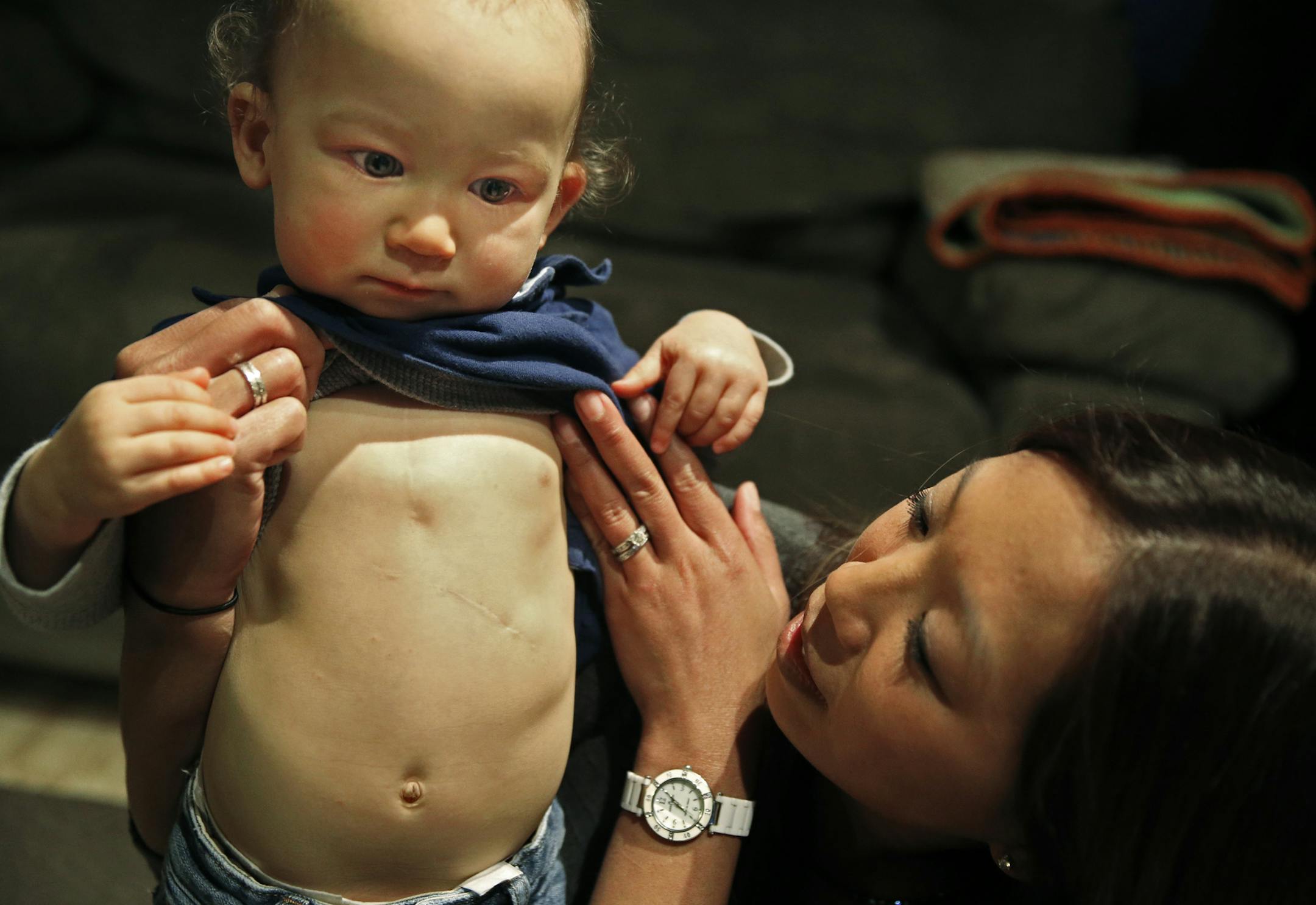 At their home in Eden Prairie, Asher Thomas, and her mother Robyn have gone through a lot of medical challenges already. Asher has an adult-sized pacemaker in his abdomen because of a congenital heart defect. ] tsong-taataarii@startribune.com