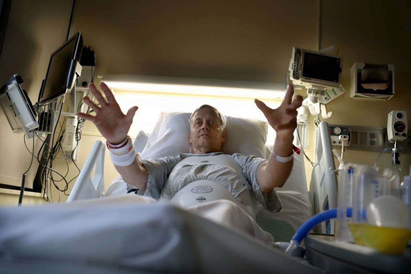 From his hospital room at HCMC, deer hunter Phil Martinson, 58, of Cokato, recounts falling from a tree while setting up his tree stand for the deer hunting season last Friday, Oct. 22. Martinson suffered a broken L1 vertebrae in the fall and had surgery on Oct. 29. Martinson wants other hunters to realize the risks in hunting from a tree stand. In the future he said he will do three things differently when hunting. He will now hunt from a tree stand equipped with a ladder. He'll also not hunt a