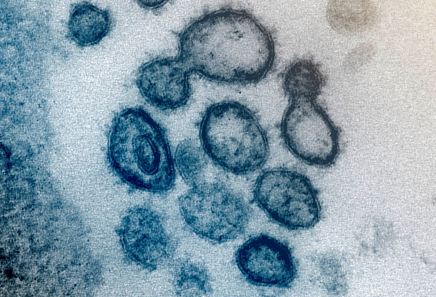 This undated electron microscope image made available by the U.S. National Institutes of Health in February 2020 shows the Novel Coronavirus SARS-CoV-2. Also known as 2019-nCoV, the virus causes COVID-19. The sample was isolated from a patient in the U.S. Dozens of research groups around the world are racing to create a vaccine as COVID-19 cases continue to grow.