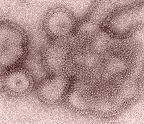 FILE - This 2011 electron microscope image provided by the Centers for Disease Control and Prevention shows H3N2 influenza virions. In January 2019, the flu season was shaping up to be one of the shortest and mildest in recent U.S. history. But a surprising second viral wave has just made it the longest, according to the flu statistics released on Friday, April 19, 2019. (Dr. Michael Shaw, Doug Jordan/Centers for Disease Control and Prevention via AP)
