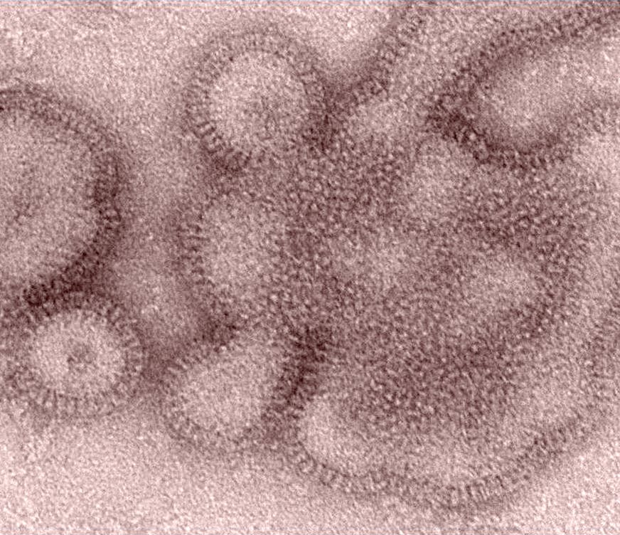 FILE - This 2011 electron microscope image provided by the Centers for Disease Control and Prevention shows H3N2 influenza virions. In January 2019, the flu season was shaping up to be one of the shortest and mildest in recent U.S. history. But a surprising second viral wave has just made it the longest, according to the flu statistics released on Friday, April 19, 2019. (Dr. Michael Shaw, Doug Jordan/Centers for Disease Control and Prevention via AP)