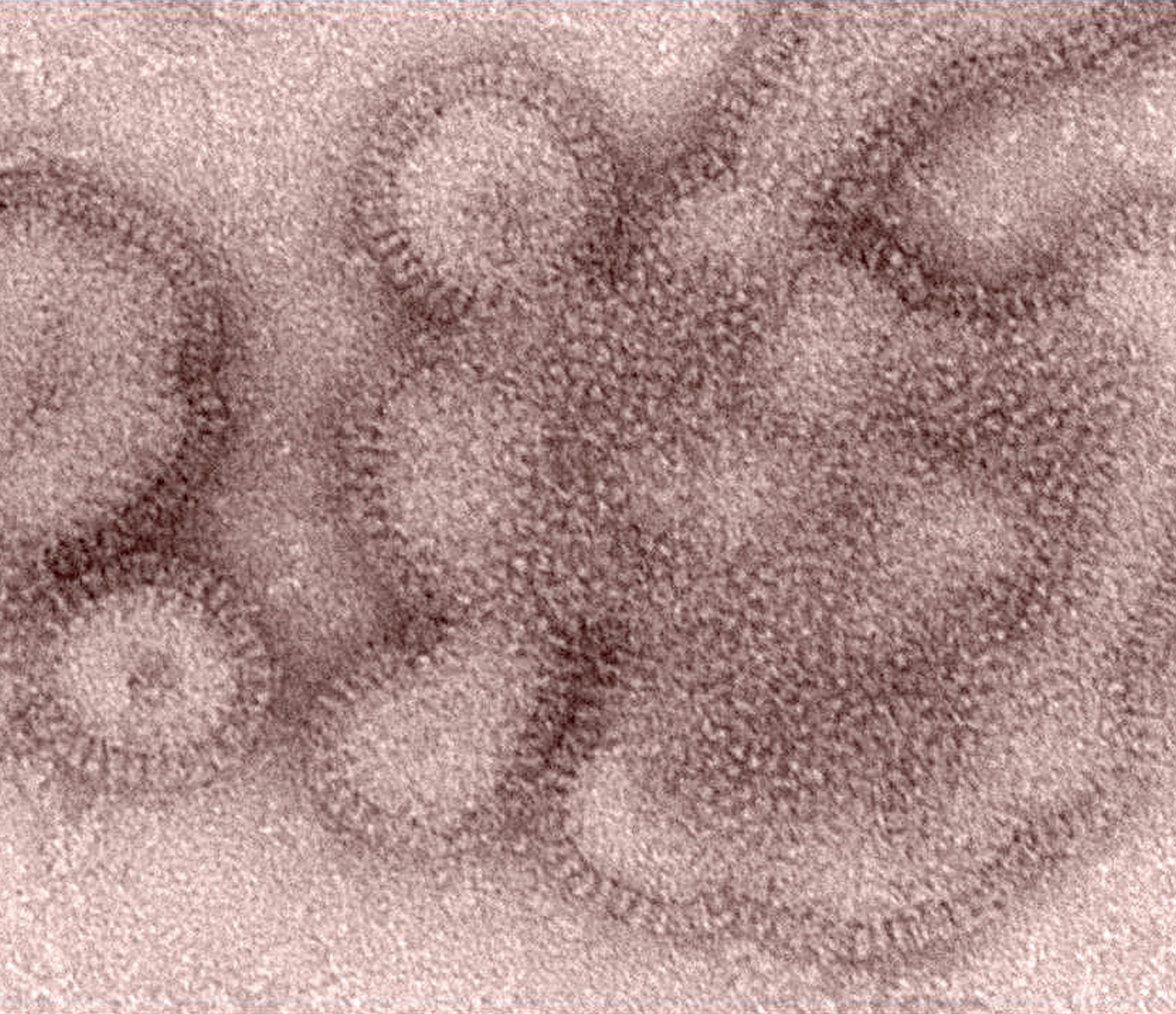 FILE - This 2011 electron microscope image provided by the Centers for Disease Control and Prevention shows H3N2 influenza virions. In January 2019, the flu season was shaping up to be one of the shortest and mildest in recent U.S. history. But a surprising second viral wave has just made it the longest, according to the flu statistics released on Friday, April 19, 2019. (Dr. Michael Shaw, Doug Jordan/Centers for Disease Control and Prevention via AP)