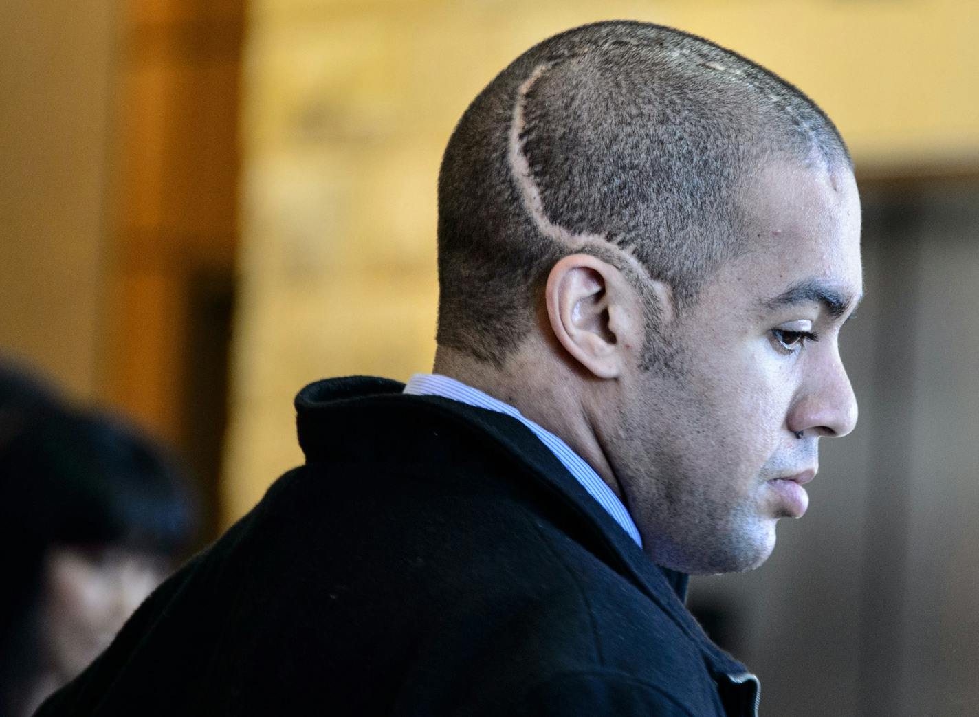 Isaac Kolstad suffered severe head injuries during an attack in Mankato at bar-closing time.