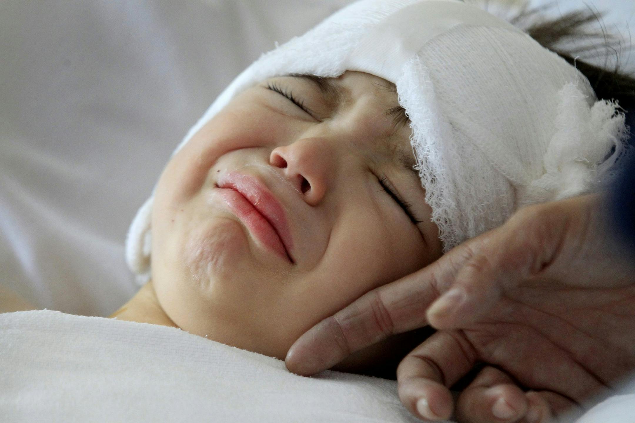 Sophie Gareau touches her son Auguste Majkowski's face as he wakes up from surgery in the ICU at Children's Hospital Los Angeles on May 6, 2014. Surgeons implanted an auditory device into Auguste's brain stem during a roughly six-hour surgery. (Brian van der Brug/Los Angeles Times/MCT)