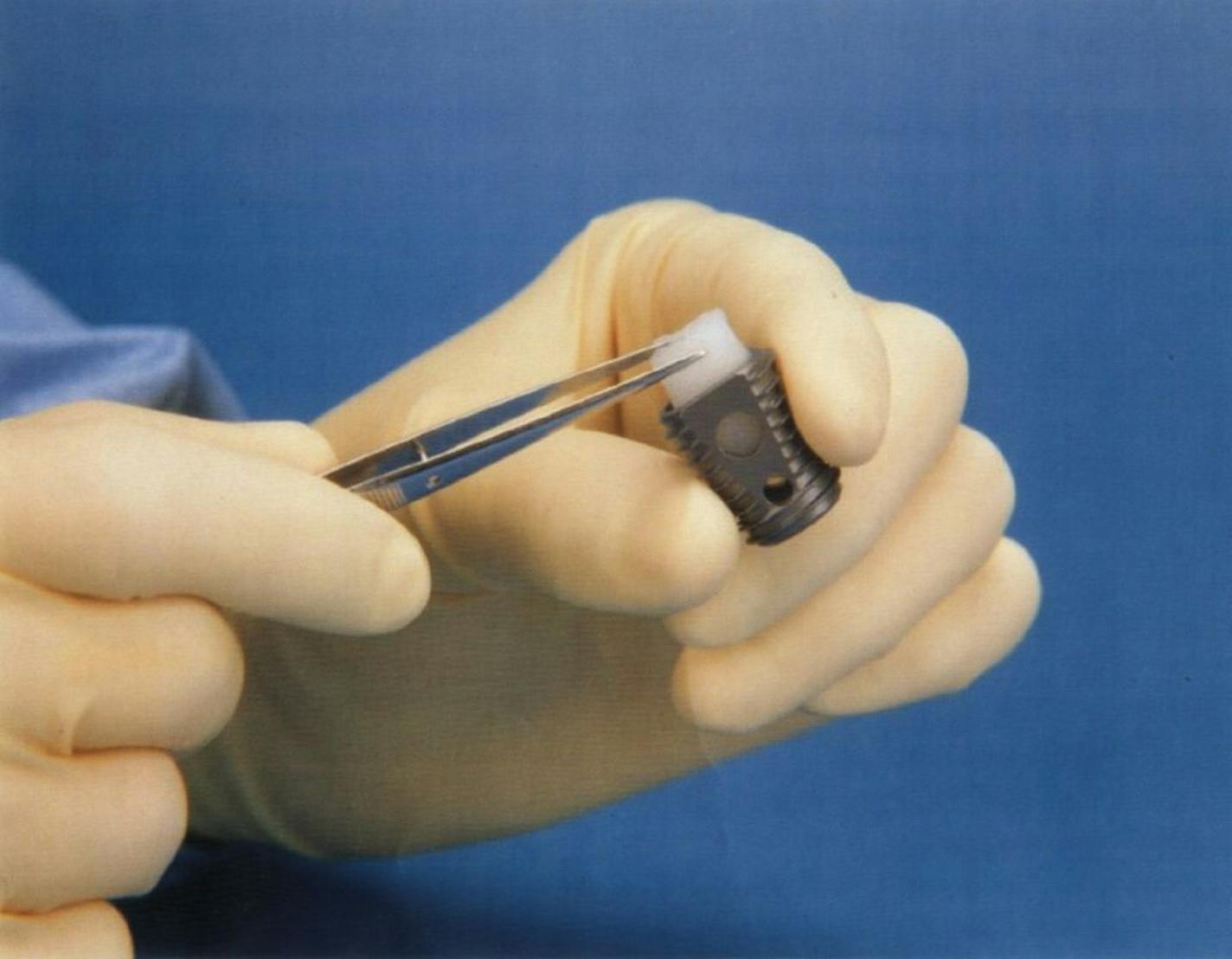 Medtronic's Infuse bone graft had been OK'd in 2002 for use in spine fusion surgeries on the lower back.