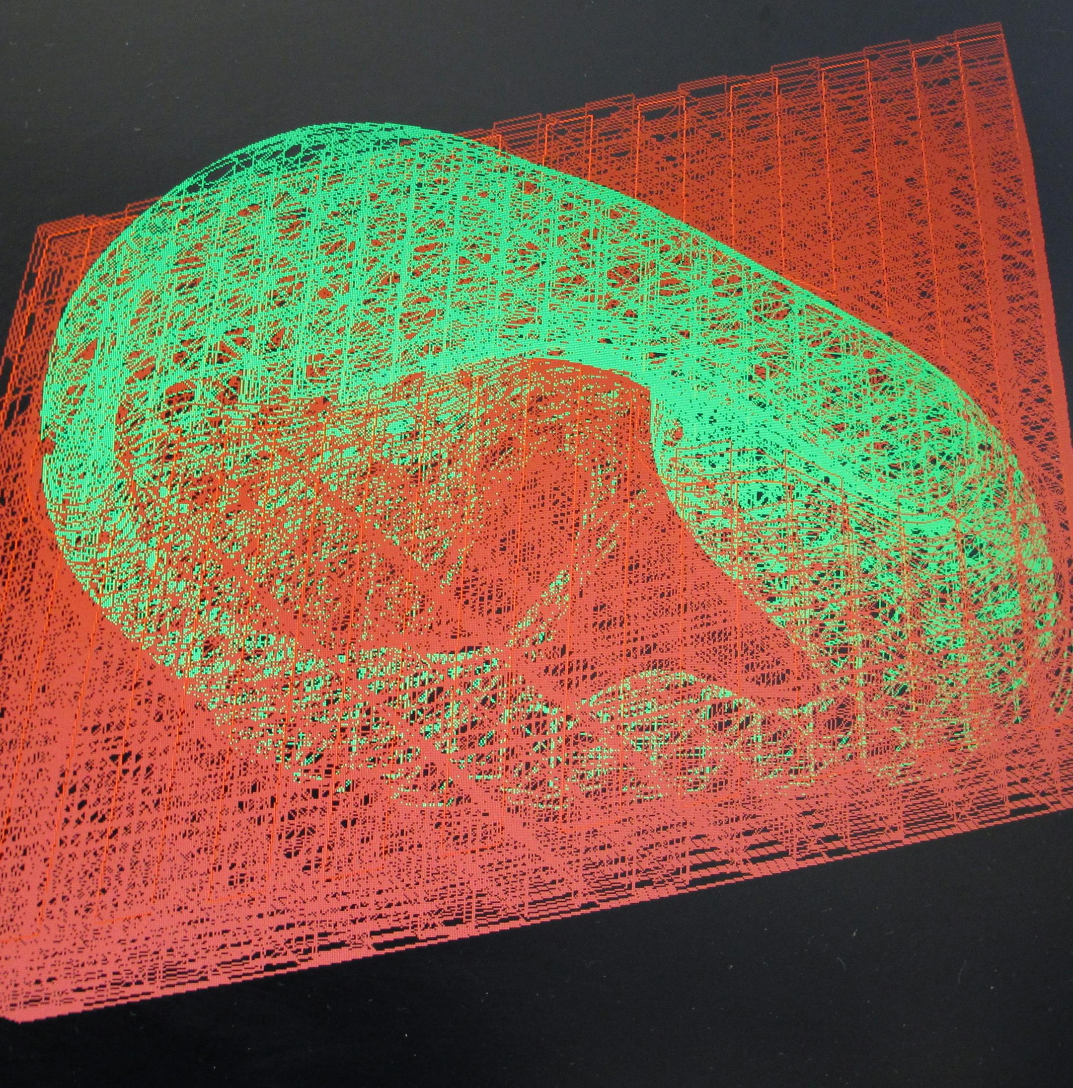 The scaffolding for a replacement nose