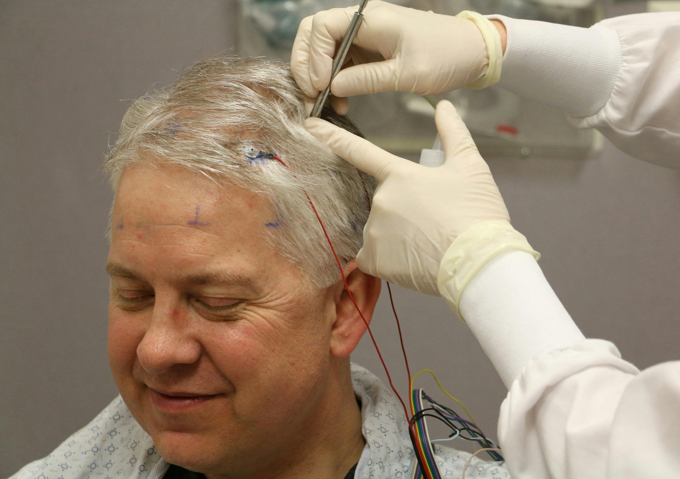Deedre Gillis, a registered EEG technician at the Mayo Clinic, wires up Polk County Attorney Greg Widseth for a checkup on an electroencephalogram. Widseth, 47, is recovering from cascading seizures set off a year ago by a mysterious form of autoimmune encephalitis. ] Dan Browning/Star Tribune