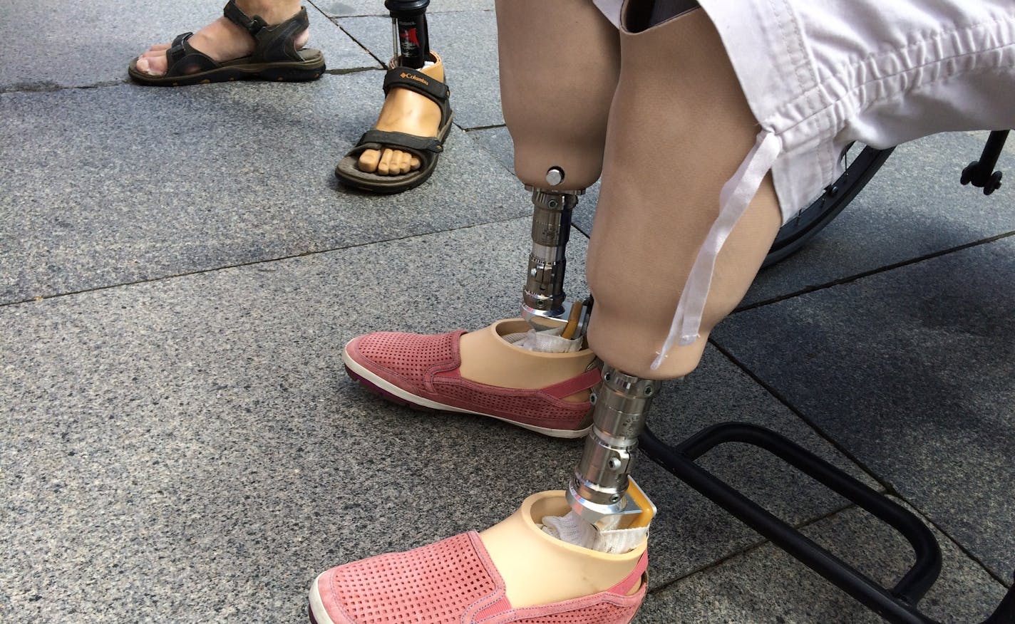 Ann Morris of St. Louis Park is on her fourth pair of artificial legs in five years. Limiting the number and kinds of prosthetics Medicare will pay for is a step backward, she said.