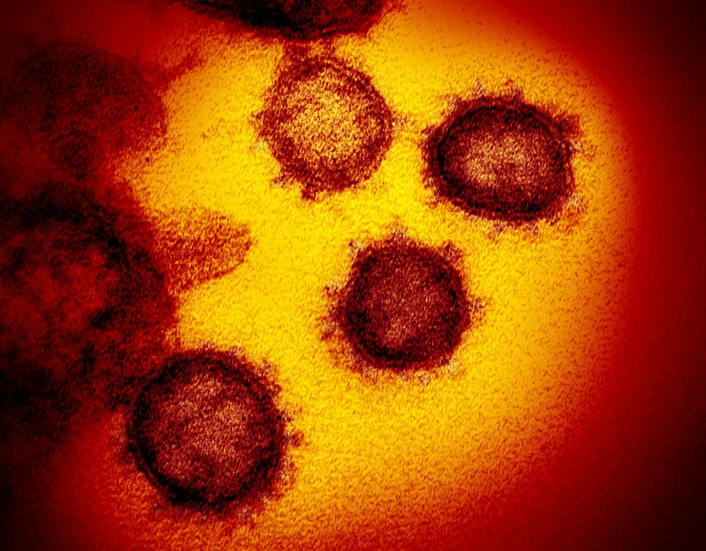 An undated photo provided by the National Institutes of Health shows a transmission electron microscope image of 2019-nCoV, the virus that causes COVID-19, isolated from a patient in the U.S., emerging from the surface of cells cultured in a lab. This strain of coronavirus first appeared in China in December 2019.