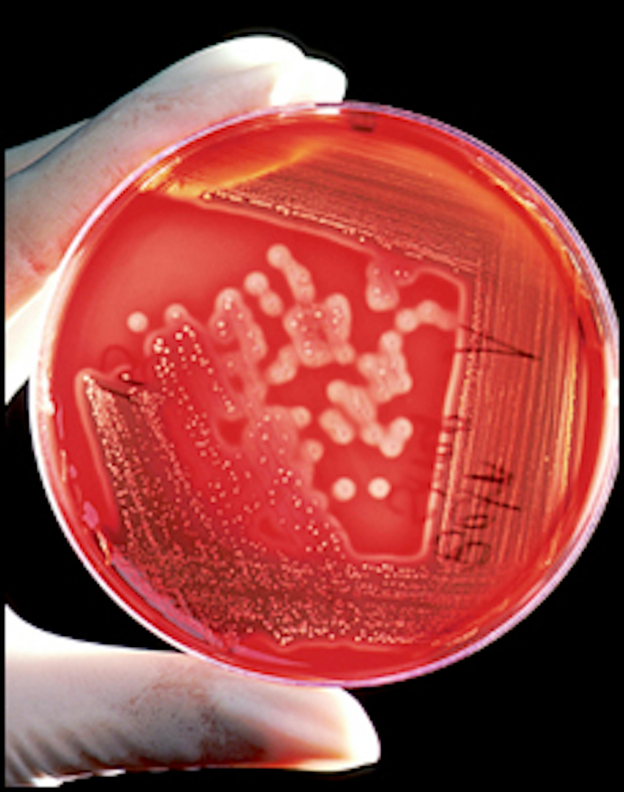 Agar plate