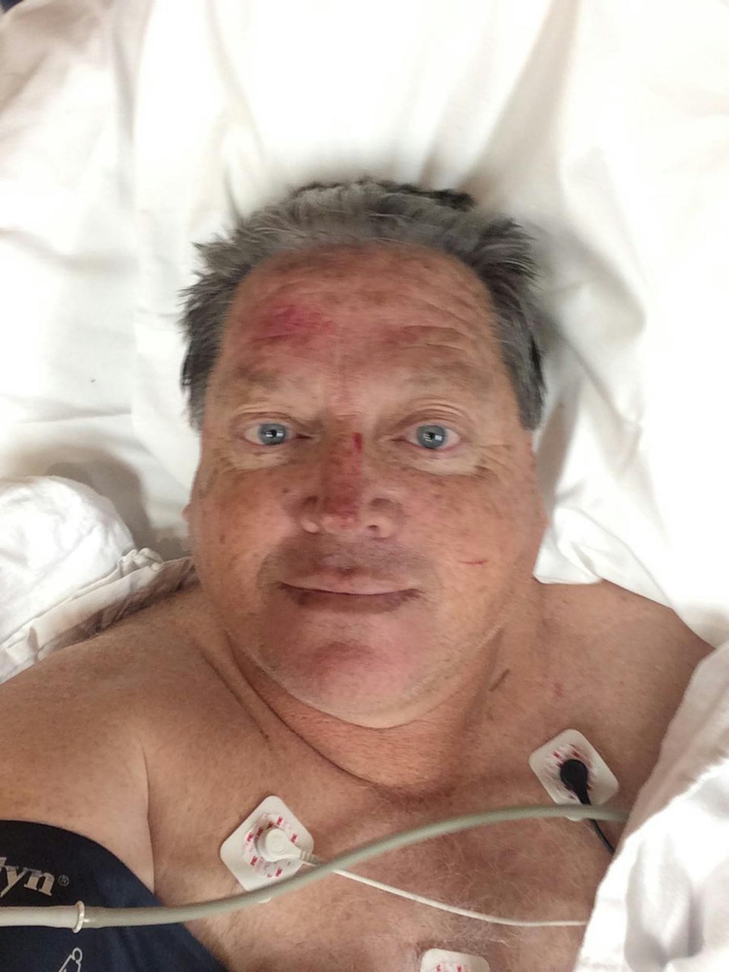 Tim Droogsma tweeted this post-crash self-portrait.