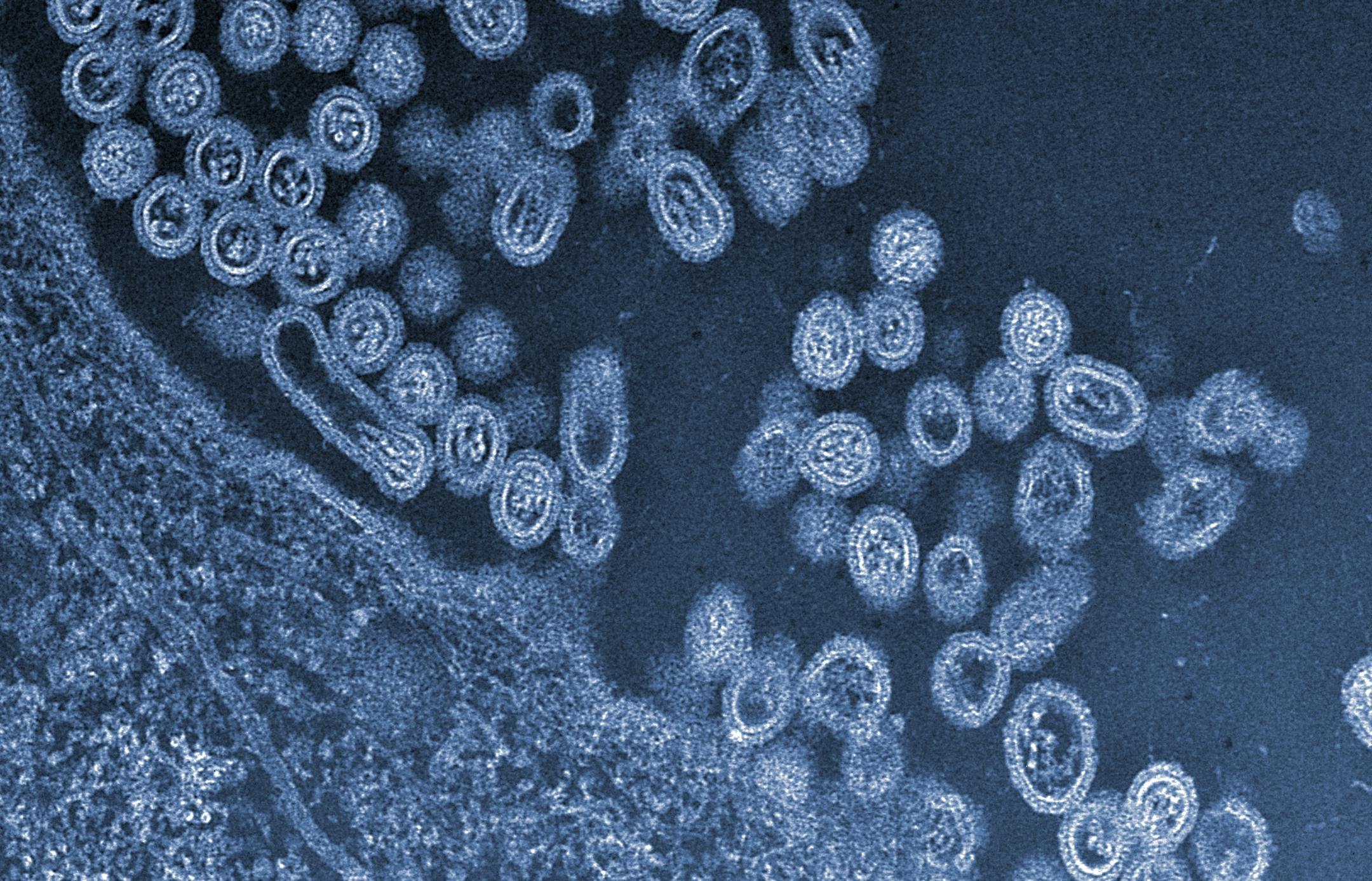 This undated handout image provided by Science and the University of Tokyo shows infectious particles of the avian H7N9 virus emerging from a cell. Scientists who sparked an outcry by creating easier-to-spread versions of the bird flu want to try such experiments again using a worrisome new strain. Since it broke out in China in March, the H7N9 bird flu has infected more than 130 people and killed 43. Leading flu researchers say that genetically engineering this virus in the lab could help track