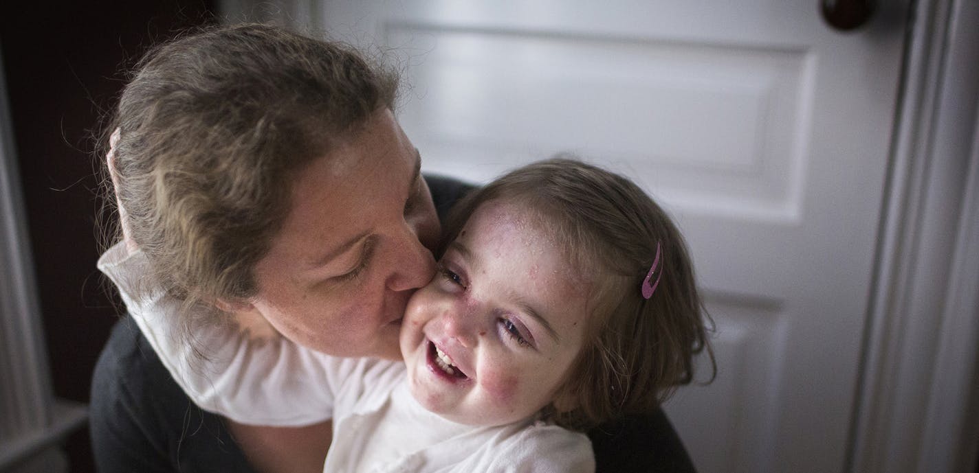 Elisa McCann, 2, plays with her mother Gabriella in their St. Paul home on Tuesday, October 6, 2015. ] LEILA NAVIDI leila.navidi@startribune.com / BACKGROUND INFORMATION: 2-year-old Elisa McCann was born with a genetic condition, epidermolysis bullosa, that causes her skin to blister and sluff off at the slightest contact. It's like having third-degree burns all over your body and drugs like oxycodone and morphine are not good long term solutions to manage her pain. Her mother, Gabriella McCann,