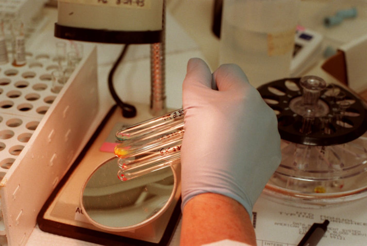 Arlene Wood, a medical lab technician at the new American Red Cross National Testing Laboratory in Eagan, tested blood types and Rh factors of various samples with the use of an agglutination viewer. The new lab, which is testing blood collected from the region, is the eighth of nine such testing centers being started by the Red Cross to test all of the blood collected in the U.S. for HIV, hepatitis, syphilis and other diseases.