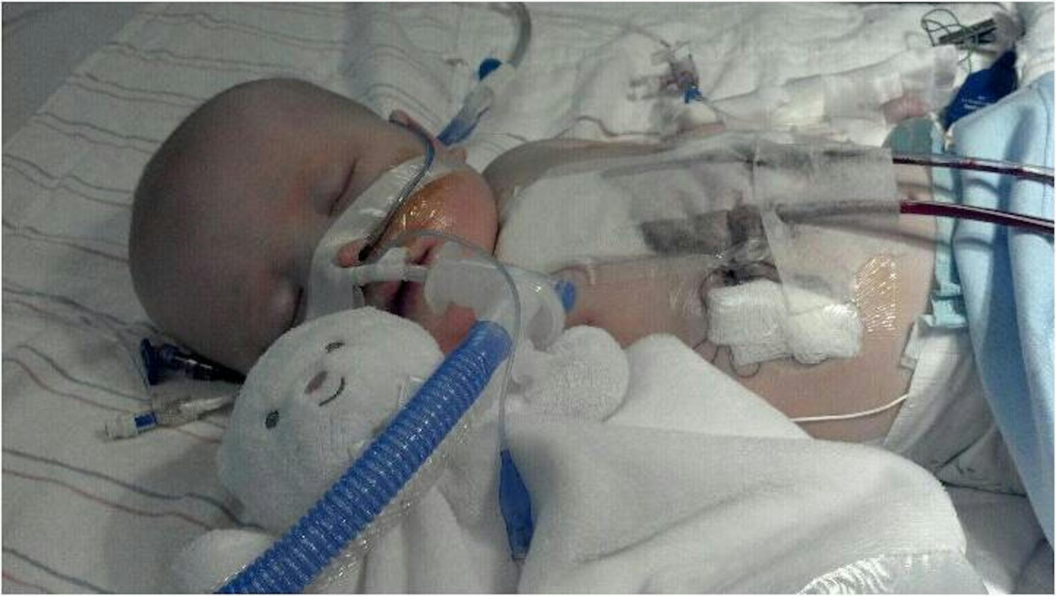 At 5 months old, Sully had to have a second surgery.