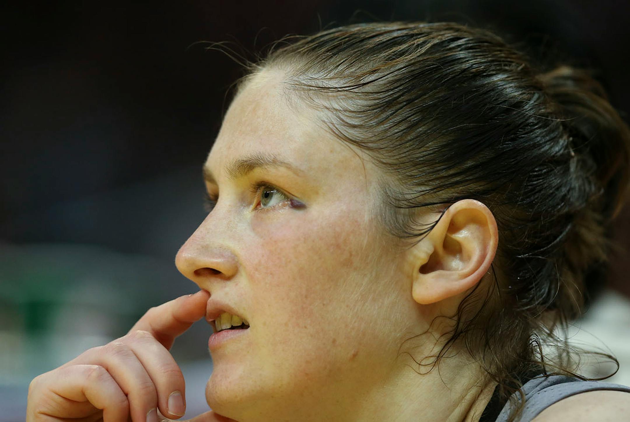 Minnesota Lynx guard Lindsay Whalen (13) had a bruise forming in the corner of her eye in the fourth quarter after a physical game against Los Angeles.