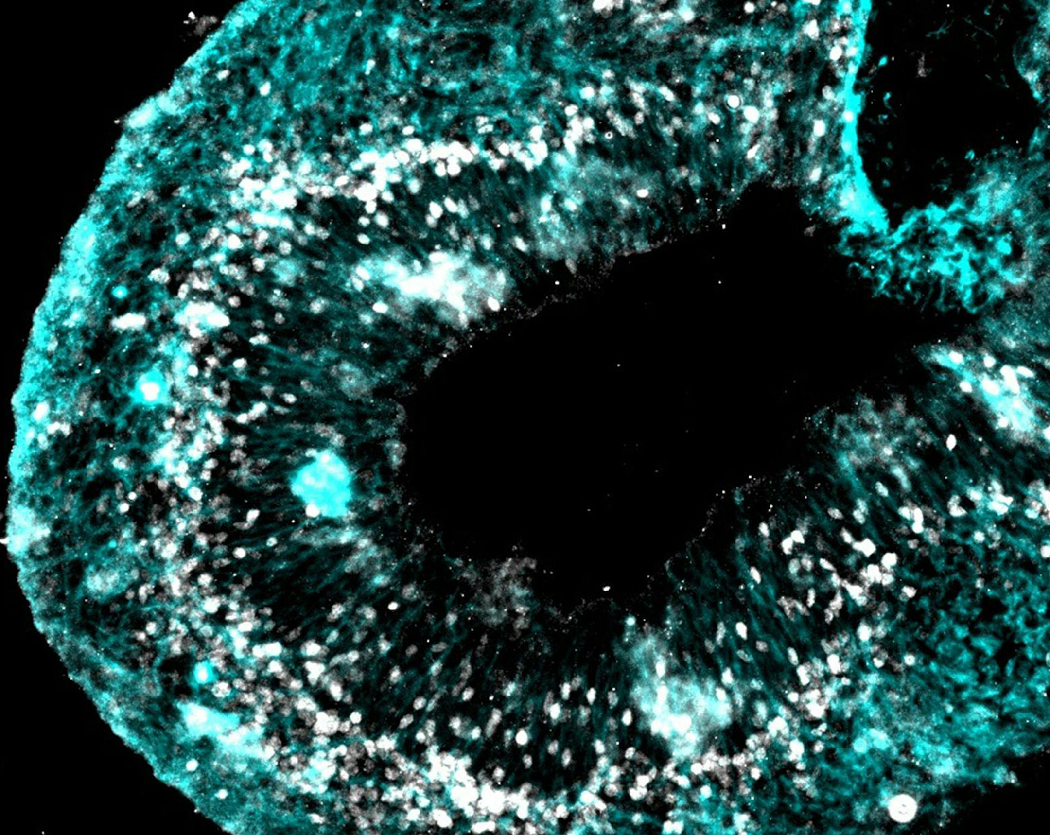 Researchers generated this ìbrain in a dishî from induced pluripotent stem cells after coaxing them to become neurons. Scientists can now harvest skin samples from the inner arms and legs of patients and grow them into small pieces of brain-like tissue, allowing them to study how genetic mutations affect brain behavior and gauge the response to drugs. Illustrates AUTISM (category a) by Simeon Bennett © 2015, Bloomberg News. Moved Monday, September 28, 2015. (MUST CREDIT: Max Salic