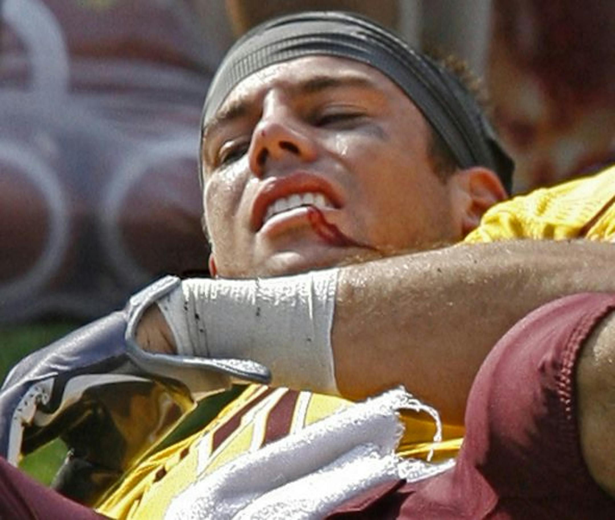 Gophers receiver Eric Decker was knocked unconscious and suffered a cut lip requiring stitches after being hit as he caught a first half touchdown pass.