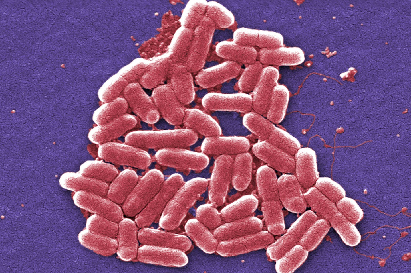 This 2006 colorized scanning electron micrograph image made available by the Centers for Disease Control and Prevention shows the O157:H7 strain of the E. coli bacteria. On Wednesday, May 26, 2016, U.S. military officials reported the first U.S. human case of bacteria resistant to an antibiotic used as a last resort drug. The 49-year-old woman has recovered from an infection of E. coli resistant to colistin. But officials fear that if the resistance spreads to other bacteria, the country may soo