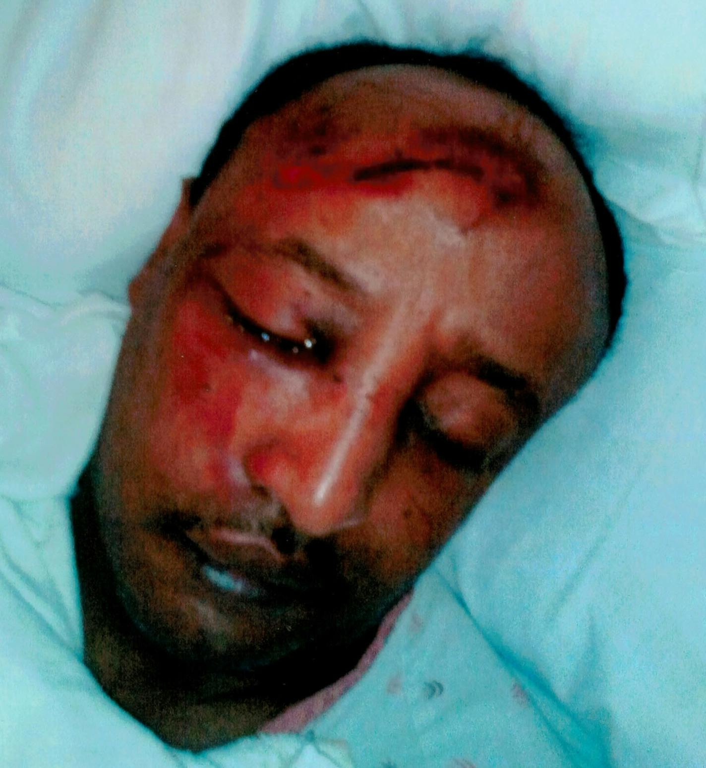 Mohamed Osman, shown here after he was kicked in the face by Minneapolis police officer Christopher Reiter, is now suing Reiter for $1 million.