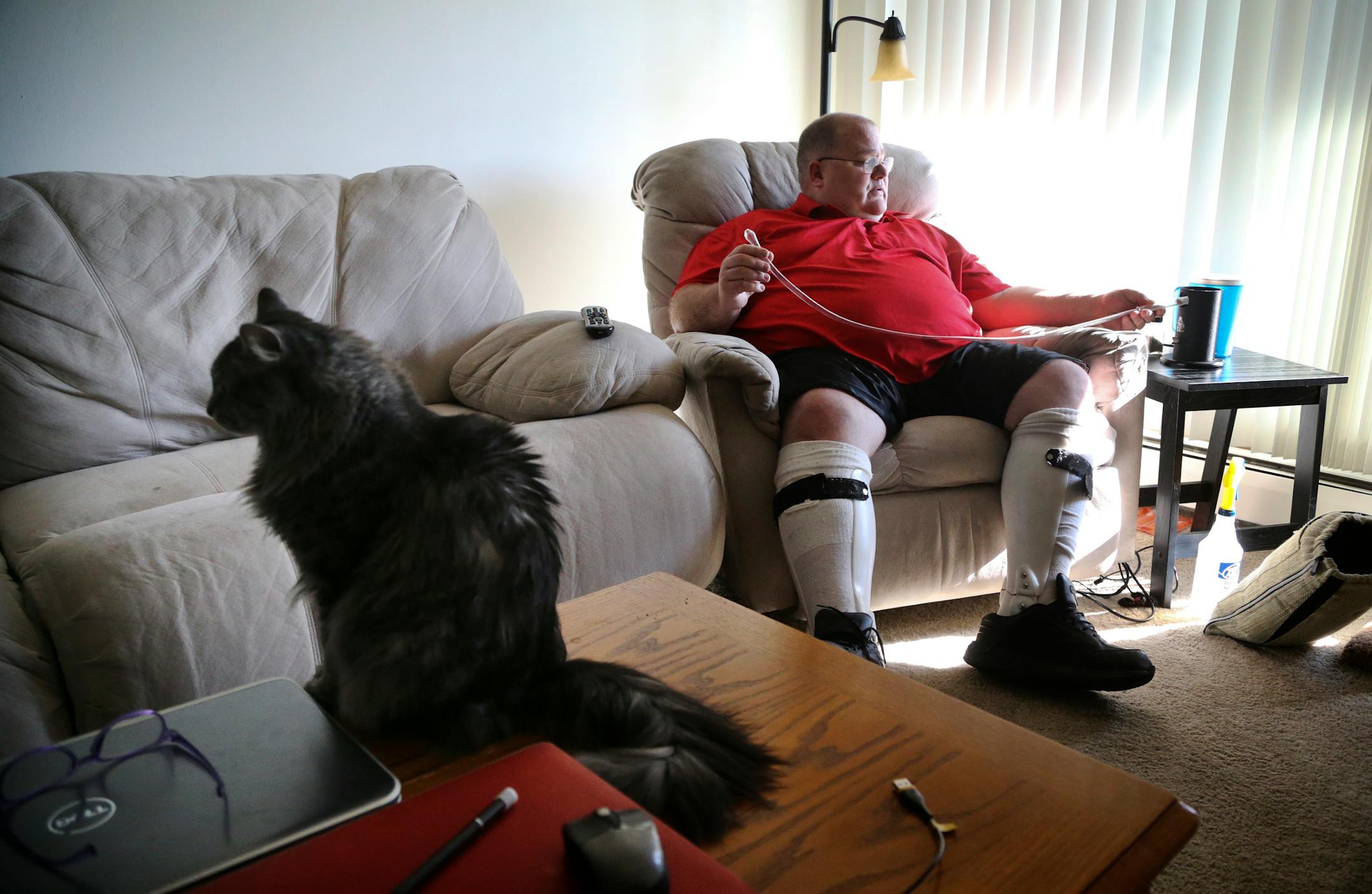 Patrick McClellan, a 47-year-old Bloomington resident, treats severe pain from muscular dystrophy by vaporizing plant marijuana he buys illegally. He doesn&#x2019;t think he will participate in the new state program because it will not allow the use of plant marijuana.