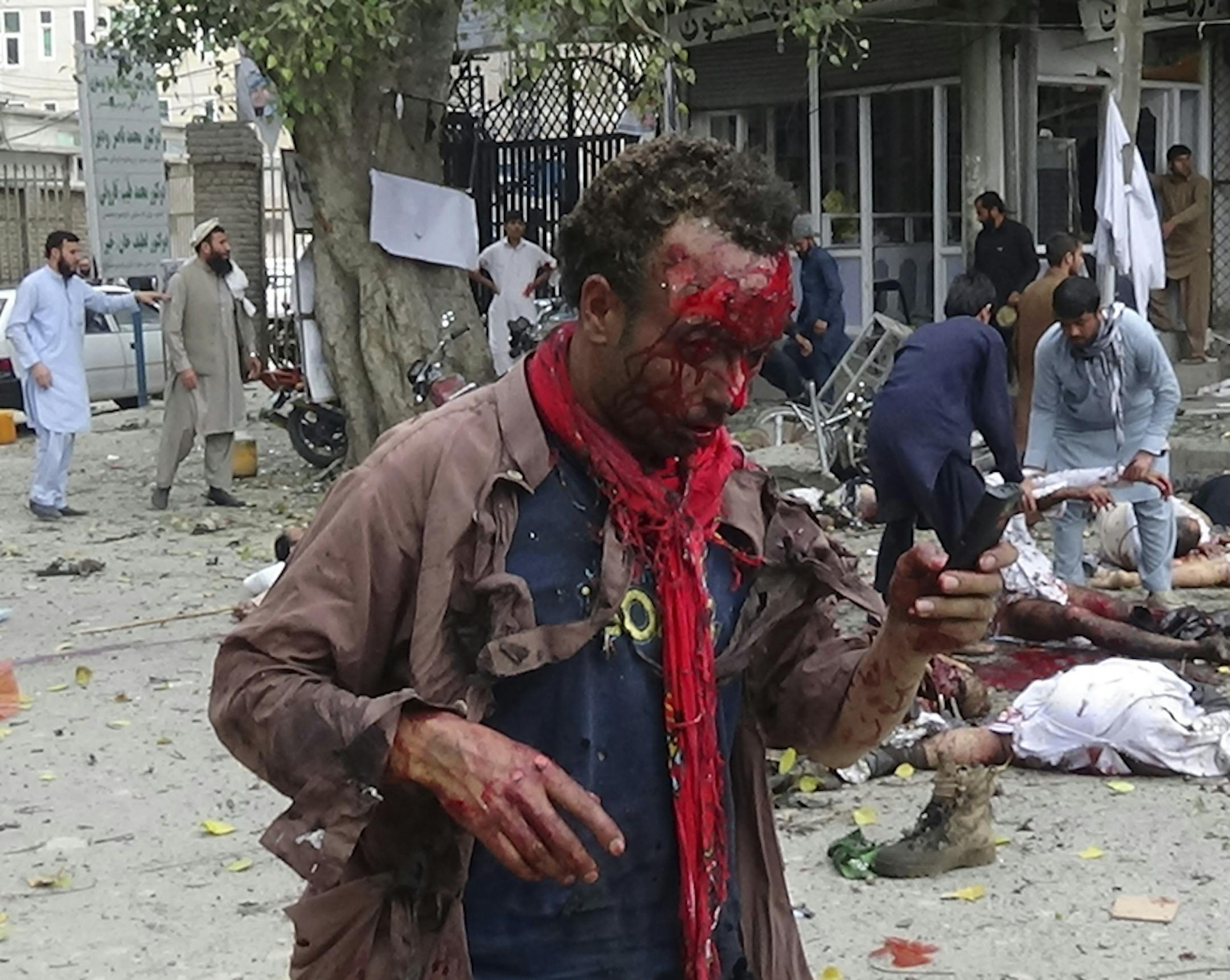 EDS NOTE: GRAPHIC CONTENT - An injured Afghan man tries to use his mobile phone while passersby try to help an injured person after a suicide attack near a bank in Jalalabad, east of Kabul, Afghanistan, Saturday, April, 18, 2015. A security official says that at least 22 people have been killed after a suicide bomber attacked a bank branch in eastern Afghanistan. (AP Photo)