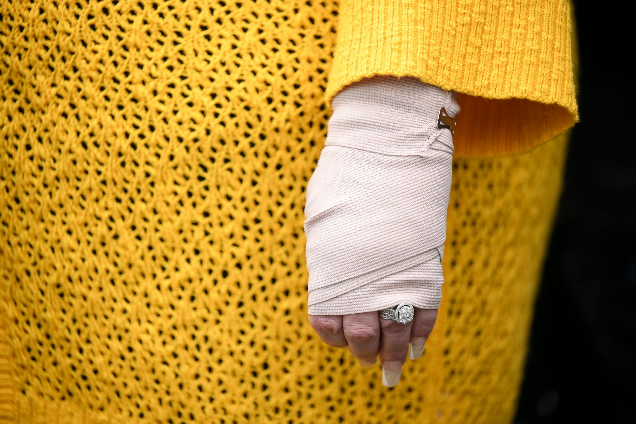 Katie Wright's left wrist Thursday, May 5, 2022 outside the Brooklyn Center Police Station.