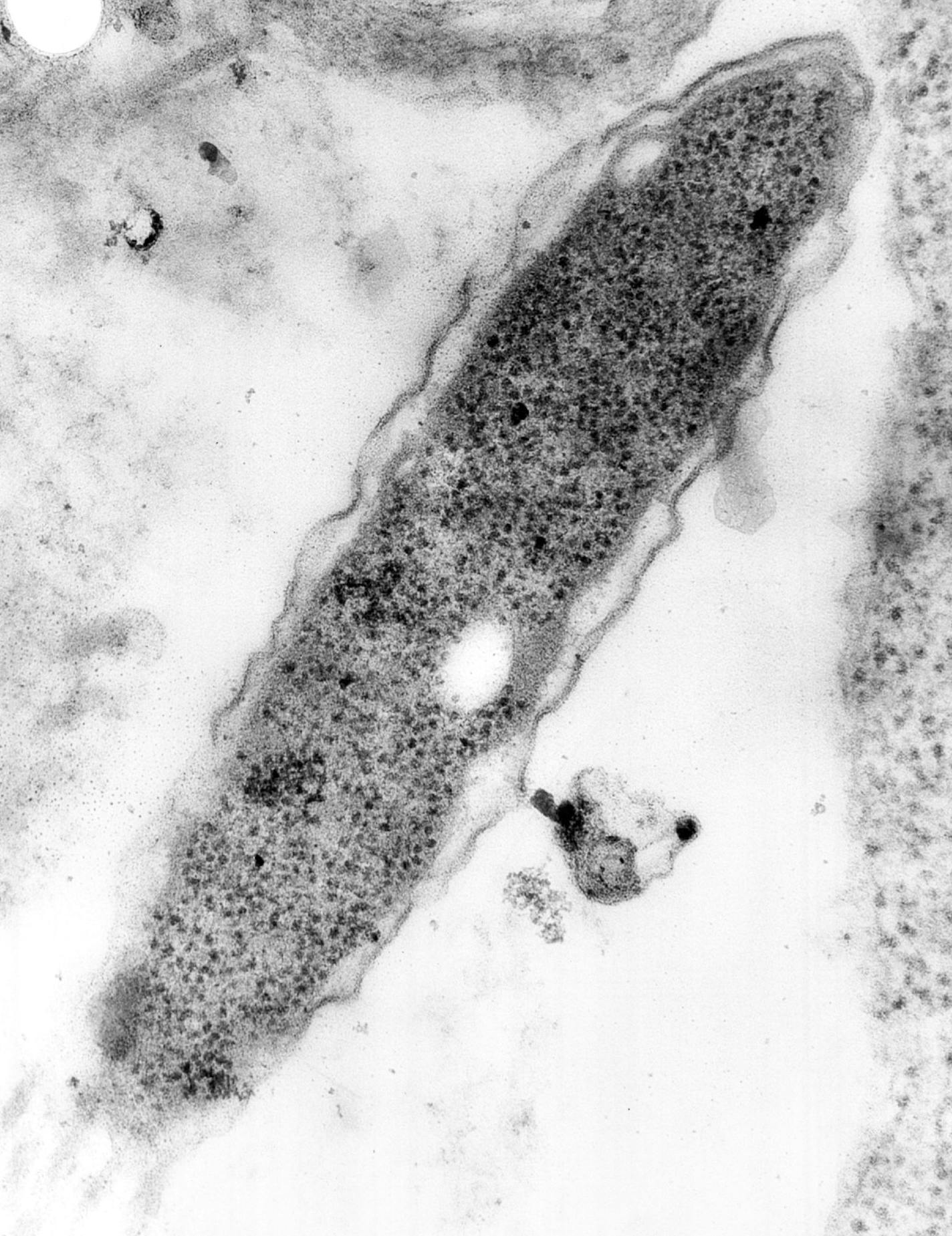 December 7, 1978 The long search for cause of legionnaires disease ended with this bacterium, which has been greatly enlarged by an electron microscope ***** This is a Magnified image of the legionnaires bacterium made from an electron microscope. A detail of this photograph appears on Page 1A.