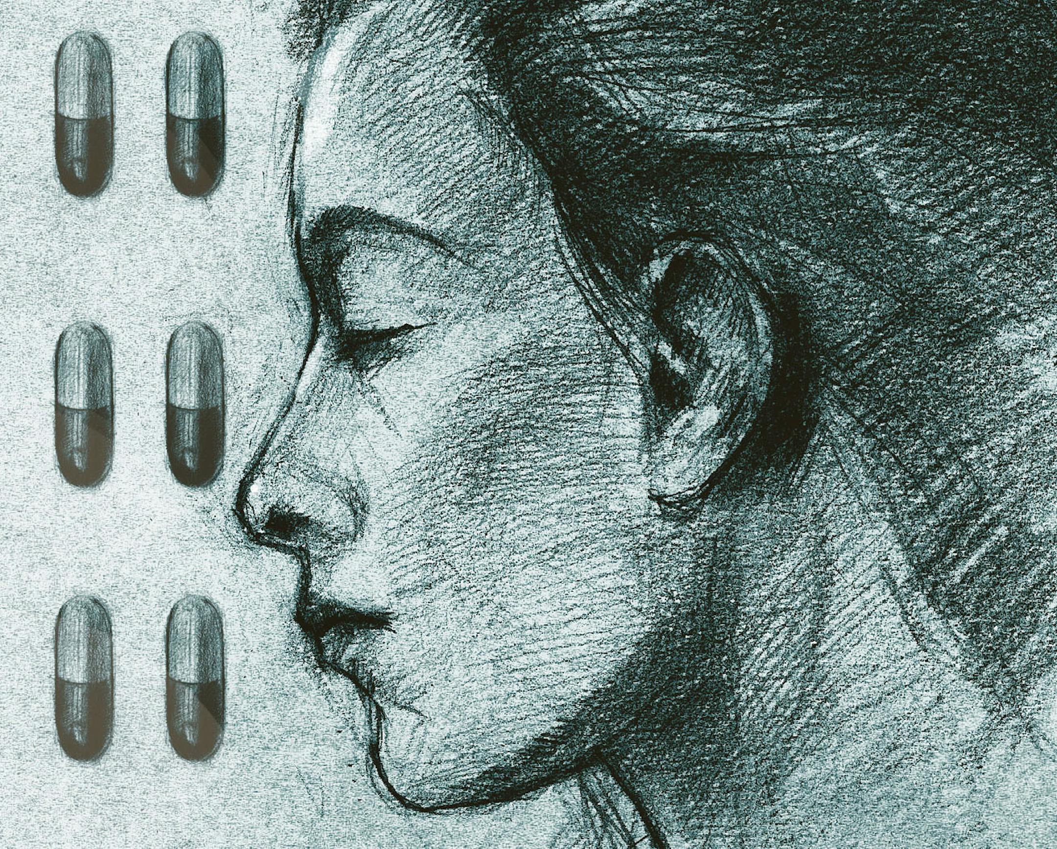 Illustration: Overmedication.