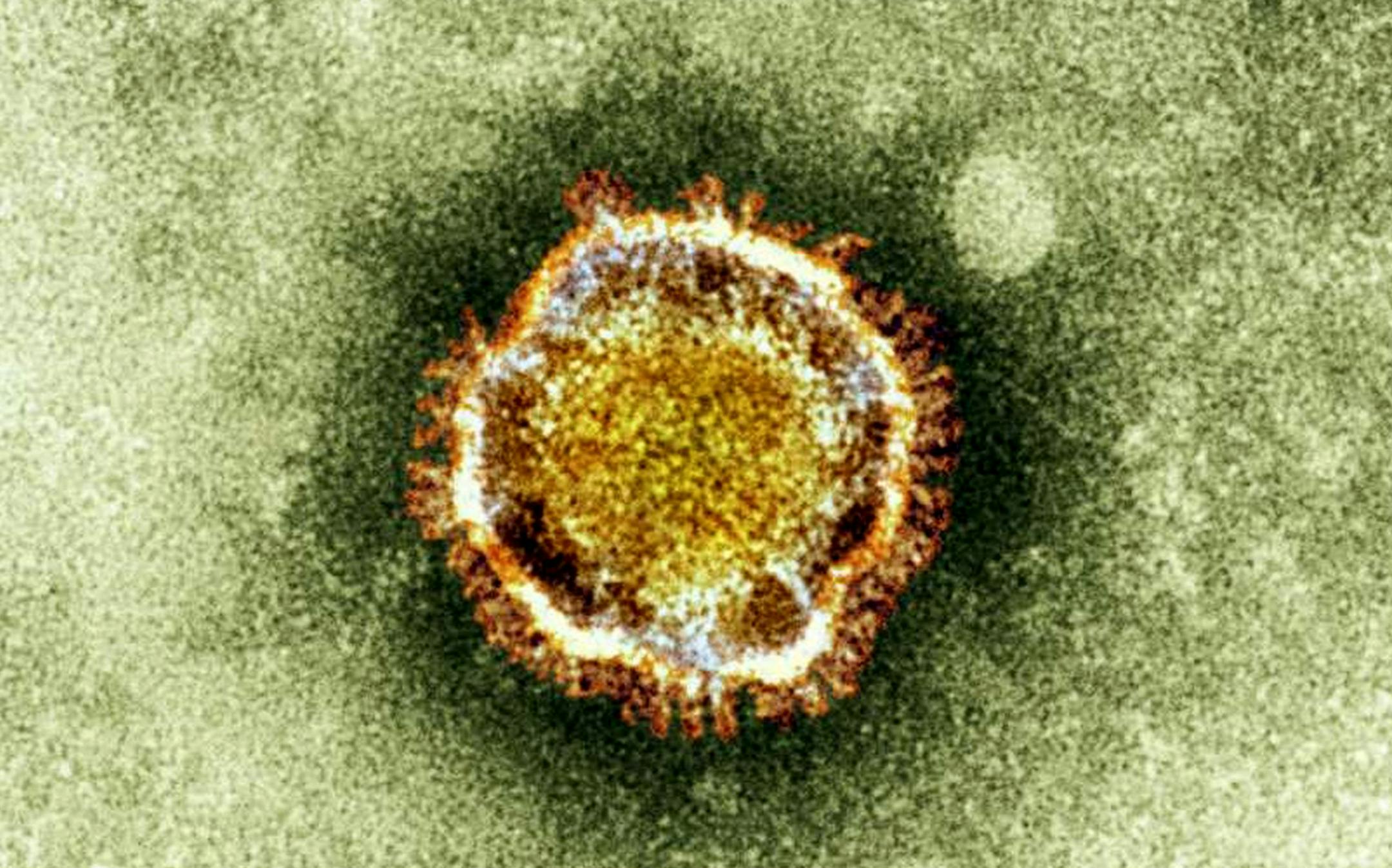 An image of a coronavirus, part of a family that causes cold, flu and SARS, in an undated handout image. New flus and viruses are emerging faster than ever, but better surveillance means they are being caught sooner. (British Health Protection Agency via The New York Times) -- EDITORIAL USE ONLY