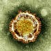 An image of a coronavirus, part of a family that causes cold, flu and SARS, in an undated handout image. New flus and viruses are emerging faster than
