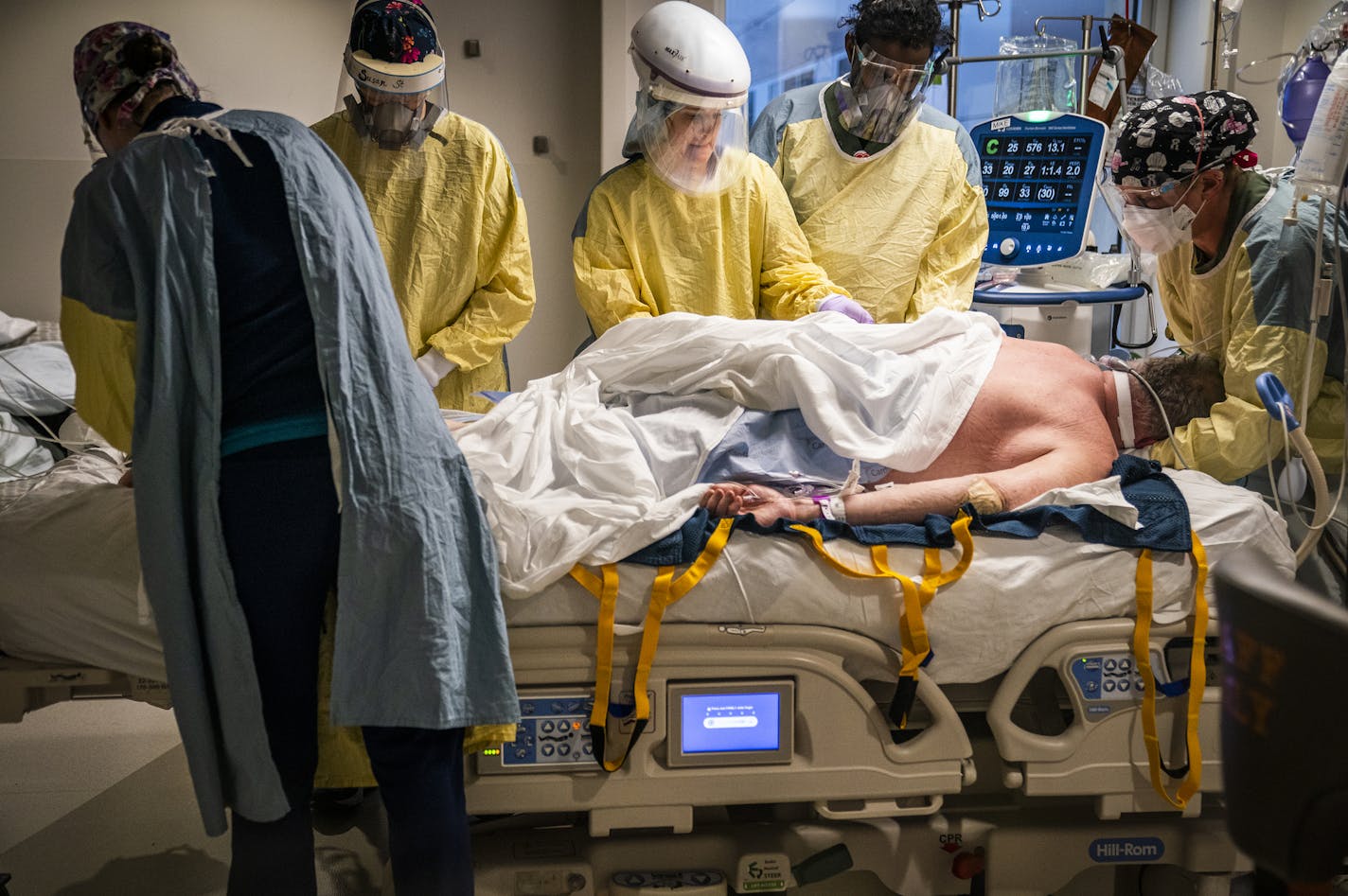 Mercy Hospital medical staff in the ICU worked to turn an intubated COVID-19 patient into the prone position to help with oxygenation.