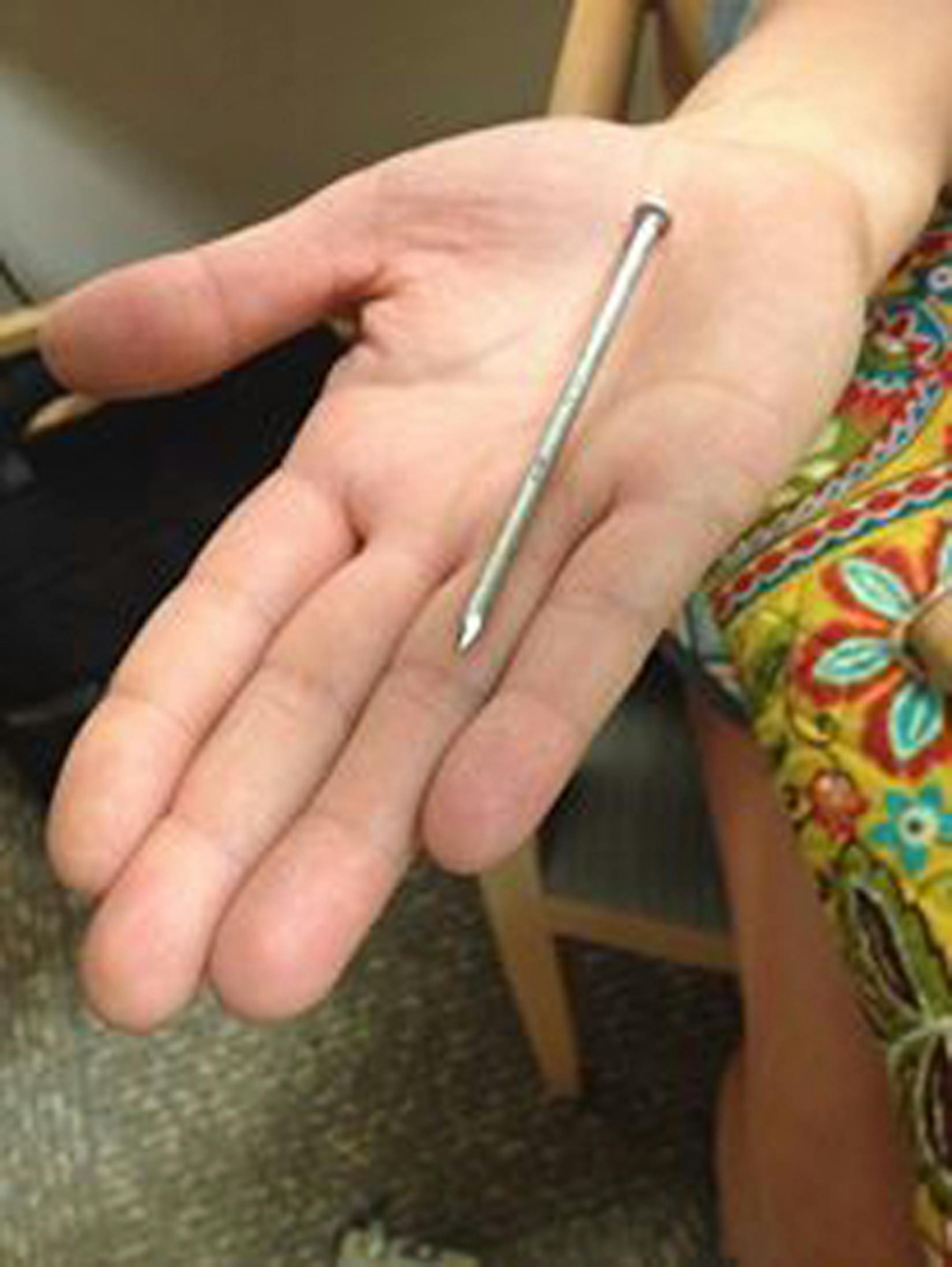 Eugene Rakow lived to tell about this nail being shot into his heart.