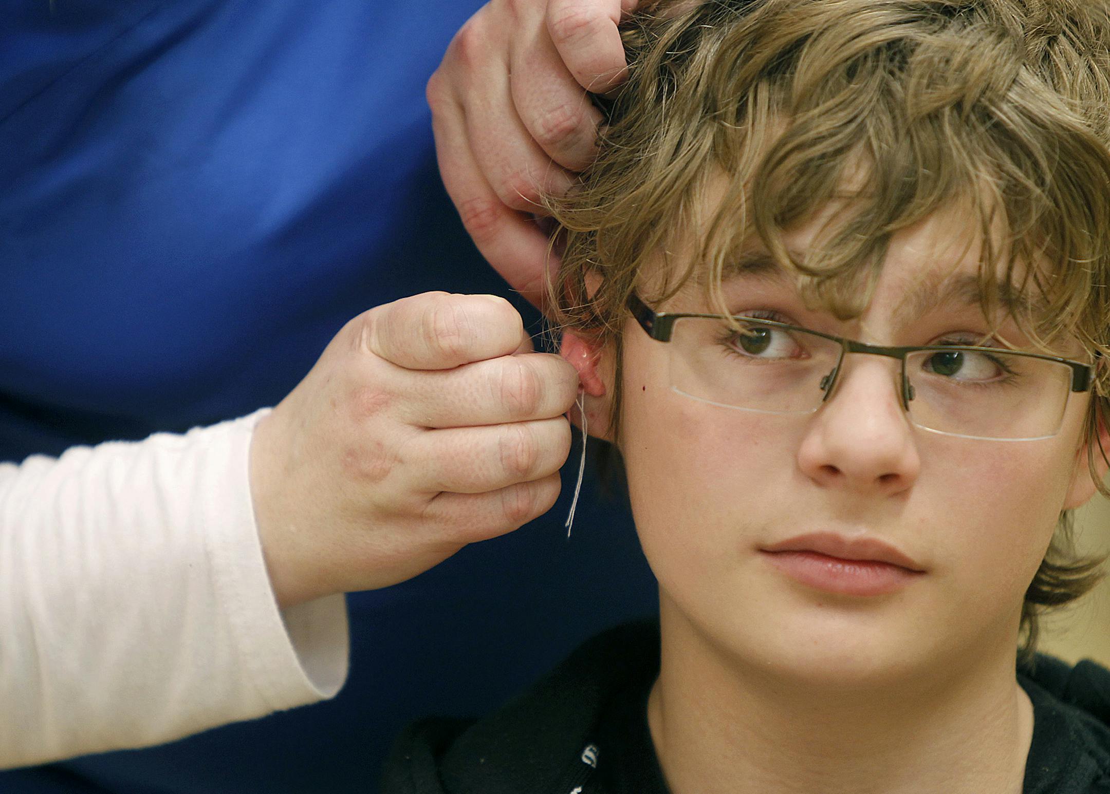 Charlie Worner, 14, who plays the saxaphone, joined hundreds of band members at Eagan High School that were fitted for custom made noise protection devices to combat the problems with hearing loss in teens, Wednesday, February 13, 2013 in Eagan, MN. (ELIZABETH FLORES/STAR TRIBUNE) ELIZABETH FLORES ¬• eflores@startribune.com ORG XMIT: MIN1302131551232129