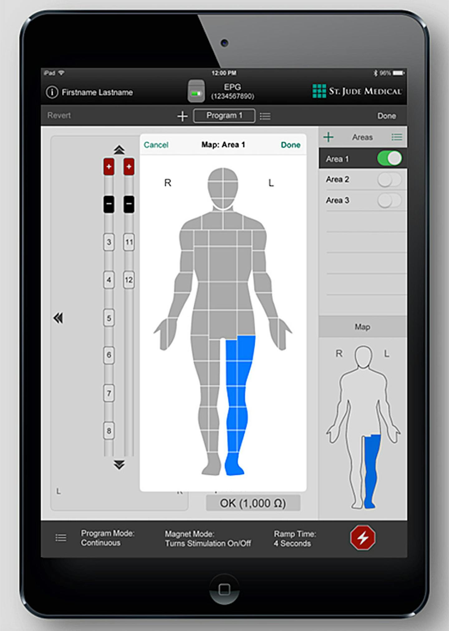 Iphone to be able to help with our Health issues