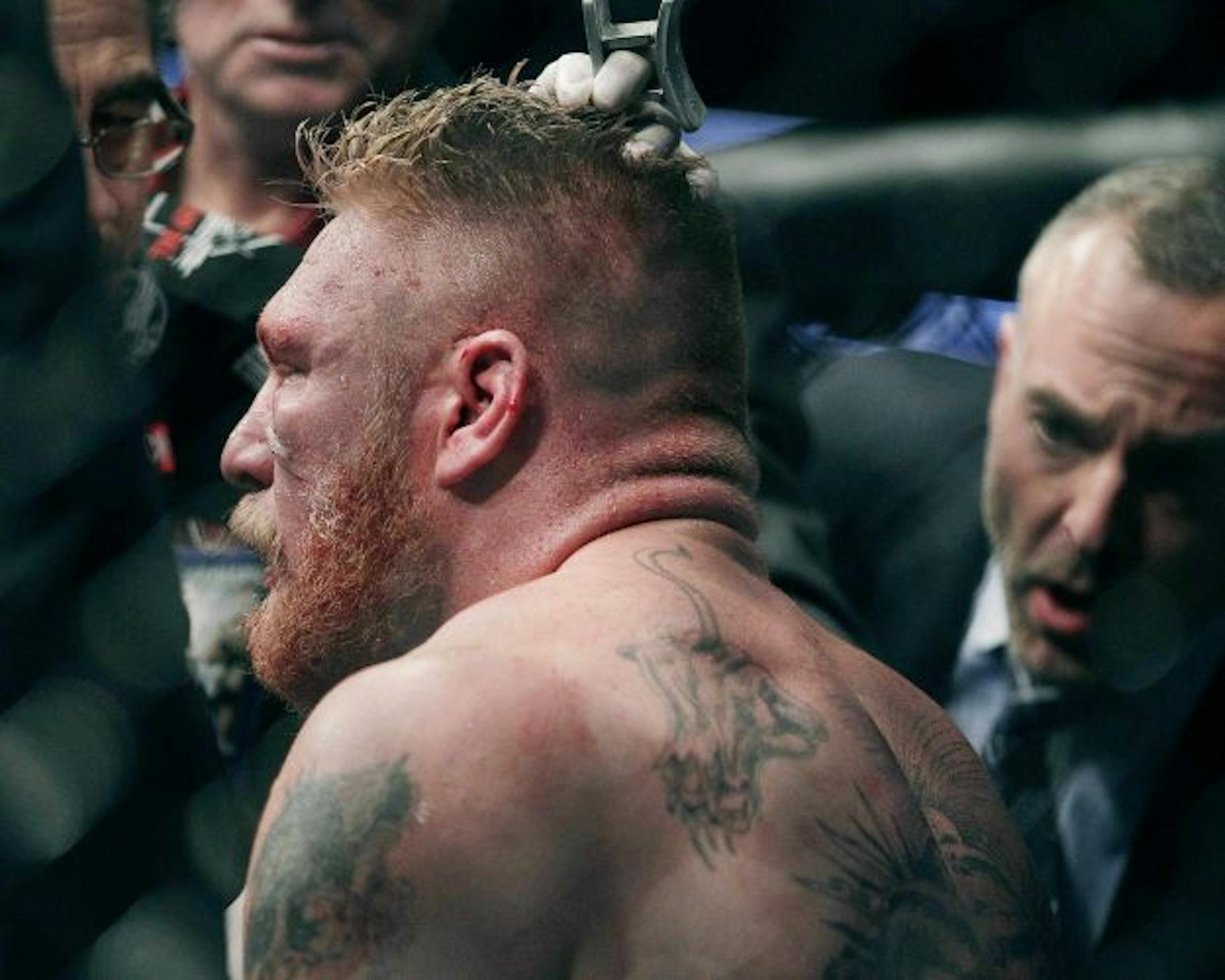 Brock Lesnar was tended to by a cut man after losing by TKO to Cain Velasquez in Saturday night's UFC 121 in Anaheim, Calif. Lesnar lost his heavyweight belt but figures to be back to contend again.