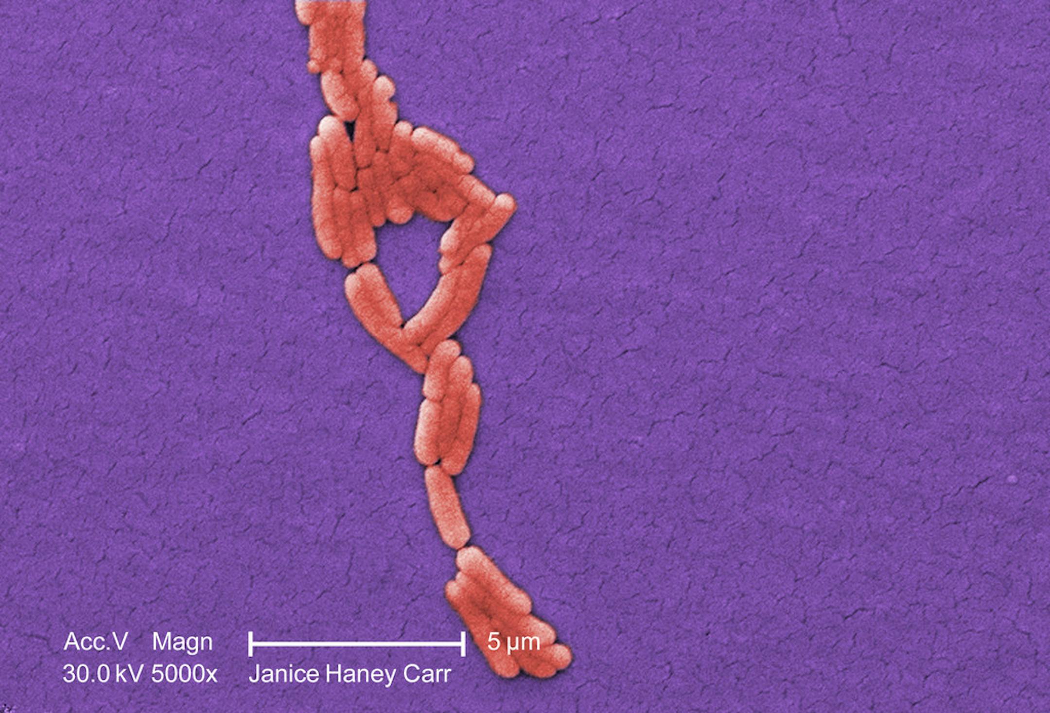 A microscopic image of clustered Gram-negative, Salmonella typhimurium bacteria, isolated from a pure culture.