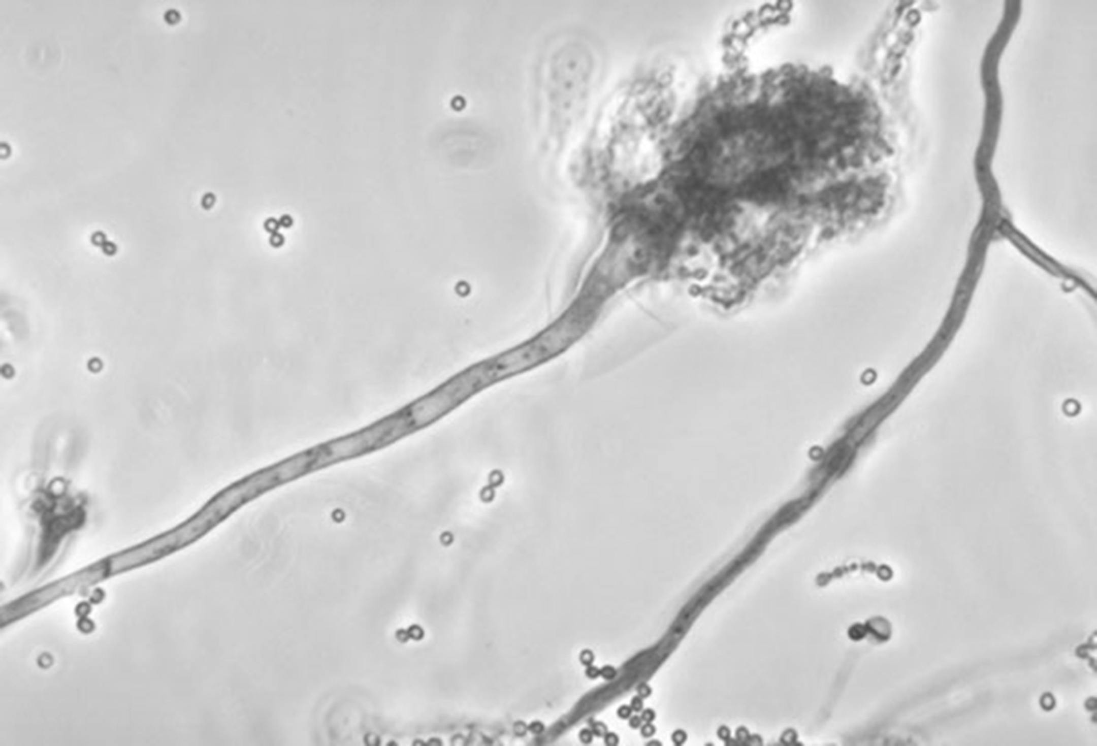 This undated photo made available by the Centers for Disease Control and Prevention shows a branch of the fungus Aspergillus fumigatus. The fungus blamed for causing a meningitis outbreak in five states is widely distributed indoors and outdoors, but only very rarely makes people sick. People inhale aspergillus fungus all the time without any problem. It's nearly impossible to avoid, found in such places as decaying leaves, trees, grain, other plants, soil, household dust, ducts for air conditio
