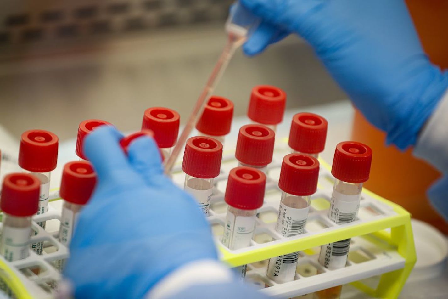 FILE - In this Wednesday, March 11, 2020 file photo, a technician prepares COVID-19 coronavirus patient samples for testing at a laboratory in New York's Long Island. Wide scale testing is a critical part of tracking and containing infectious diseases. But the U.S. effort has been plagued by a series of missteps, including accuracy problems with the test kits the CDC sent to other labs and bureaucratic hurdles that slowed the entrance of large, private sector labs.