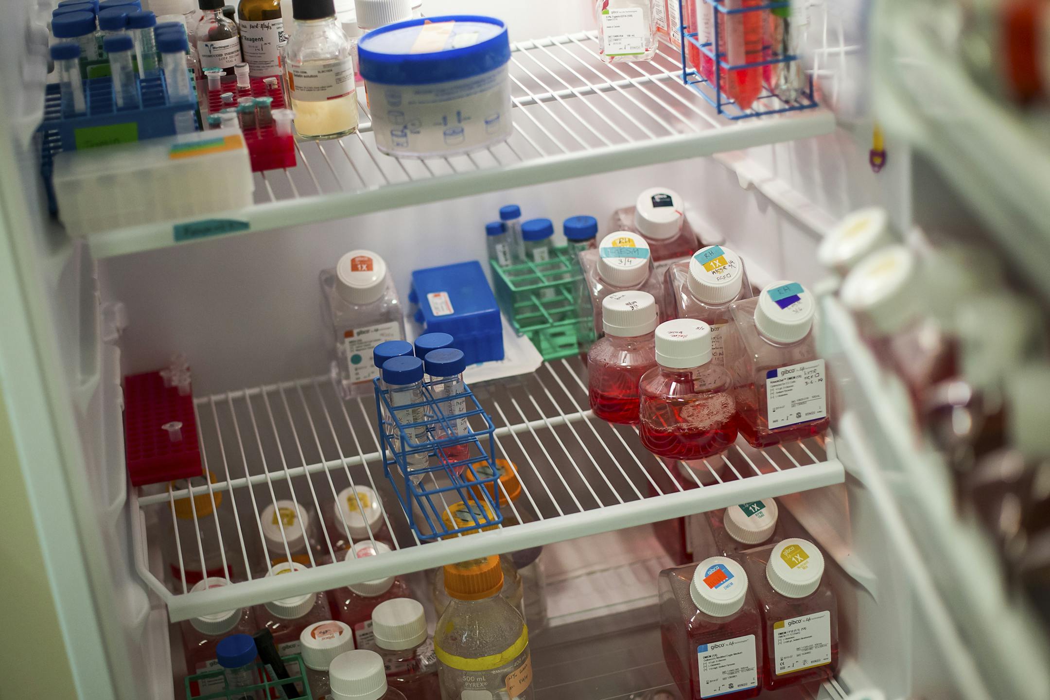 Contents inside the lab of Shoukhrat Mitalipov at the Oregon Health and Science University's National Primate Research Center in Beaverton, Ore., March 11, 2014. Mitalipov has developed a controversial fertility treatment he says can prevent women with gene defects in the cell's mitochondria from passing those traits on to their babies and, after successfully implementing the procedure in monkeys, he now hopes to begin human trials in the next few years. (Leah Nash/The New York Times) ORG XMIT: