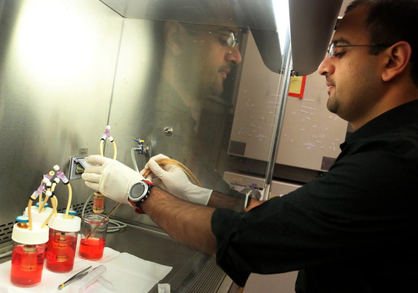 The University of Minnesota Biomedical Engineering department, led by Bob Tranquillo, is working on pediatric replacement heart valves made of human tissue. These new heart valves would be revolutionary, because they would grow with the human body and could eliminate the need for multiple surgeries for a child born with a heart valve defect. Here, Zeeshan Syedain, a University of Minnesota senior research associate, removes the liquid used to stimulate growth of sheep tissue into a pediatric hea