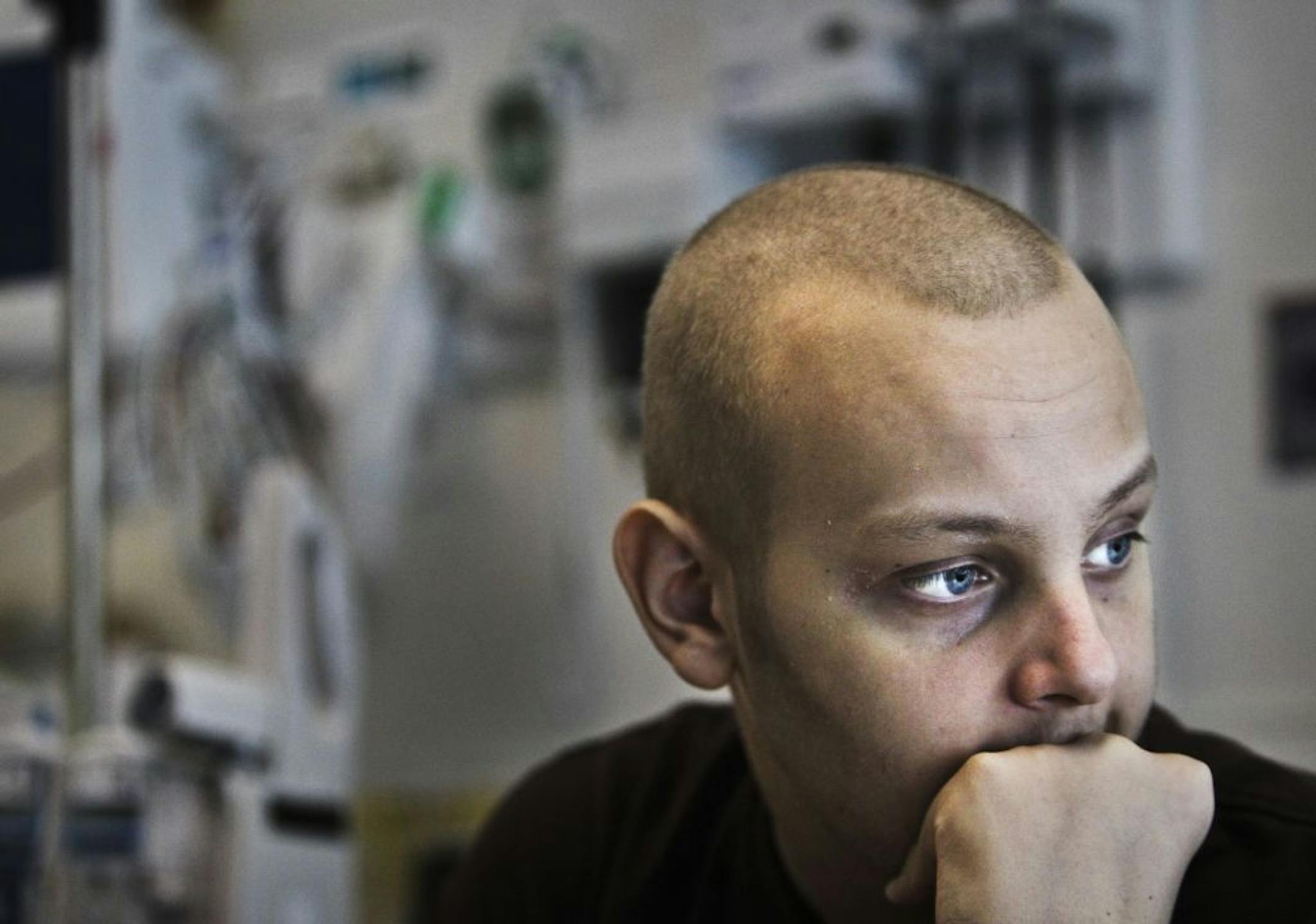 Blake Anderson, who died of leukemia on Monday, had been featured in Gail Rosenblum's column in the Sunday Star Tribune. "Patients get to a certain point where they say, 'I'm done'," his doctor said.