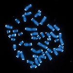 FILE - This microscope image shows the 46 human chromosomes, blue, with telomeres appearing as white pinpoints. Scientists have found the genetic caus